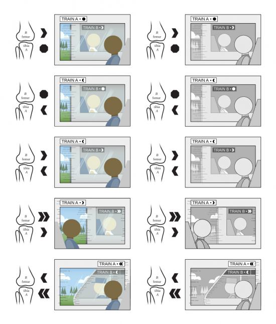 Vector illustration showing train motion analogy for different kinds of bone slippage
